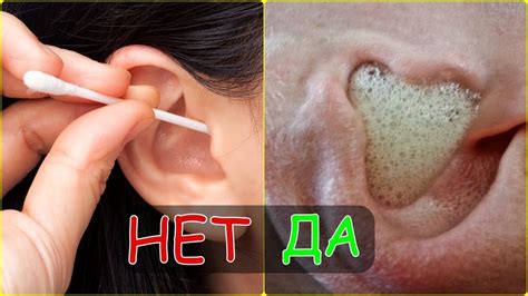 Ушная сера - вкусовые свойства и значение для здоровья